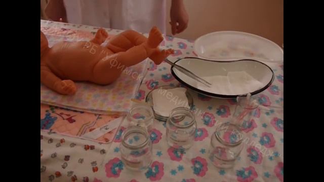 Обработка пупочной ранки