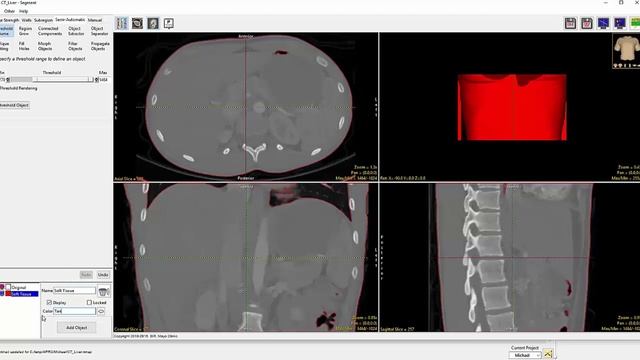 AnalyzePro: Threshold-based Segmentation смотреть онлайн