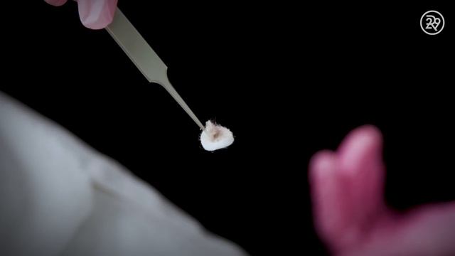 What Microdermabrasion Looks Like Up Close | Macro Beauty | Refinery29 смотреть онлайн