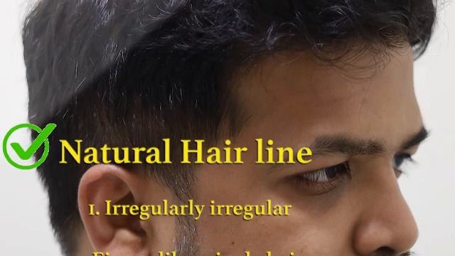 Why Hairline design is important for a Good Hair Transplant? | Dr Alok Sahoo смотреть онлайн