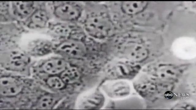 Henrietta Lacks Family смотреть онлайн