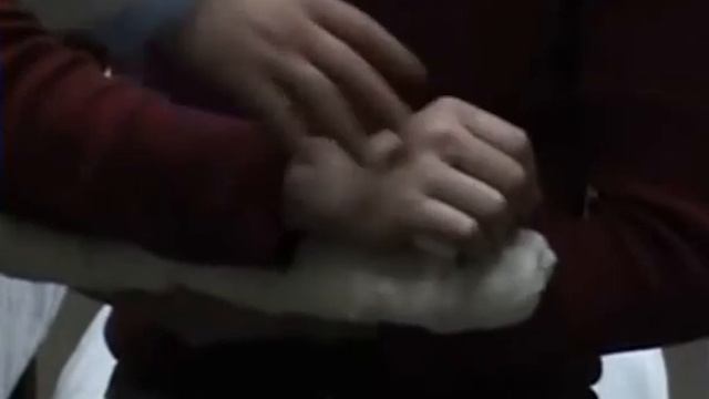 наложение шины при переломе кисти смотреть онлайн