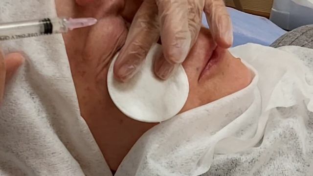 АирисКом студенты учатся: инъекции на веках для устранения морщин. смотреть онлайн