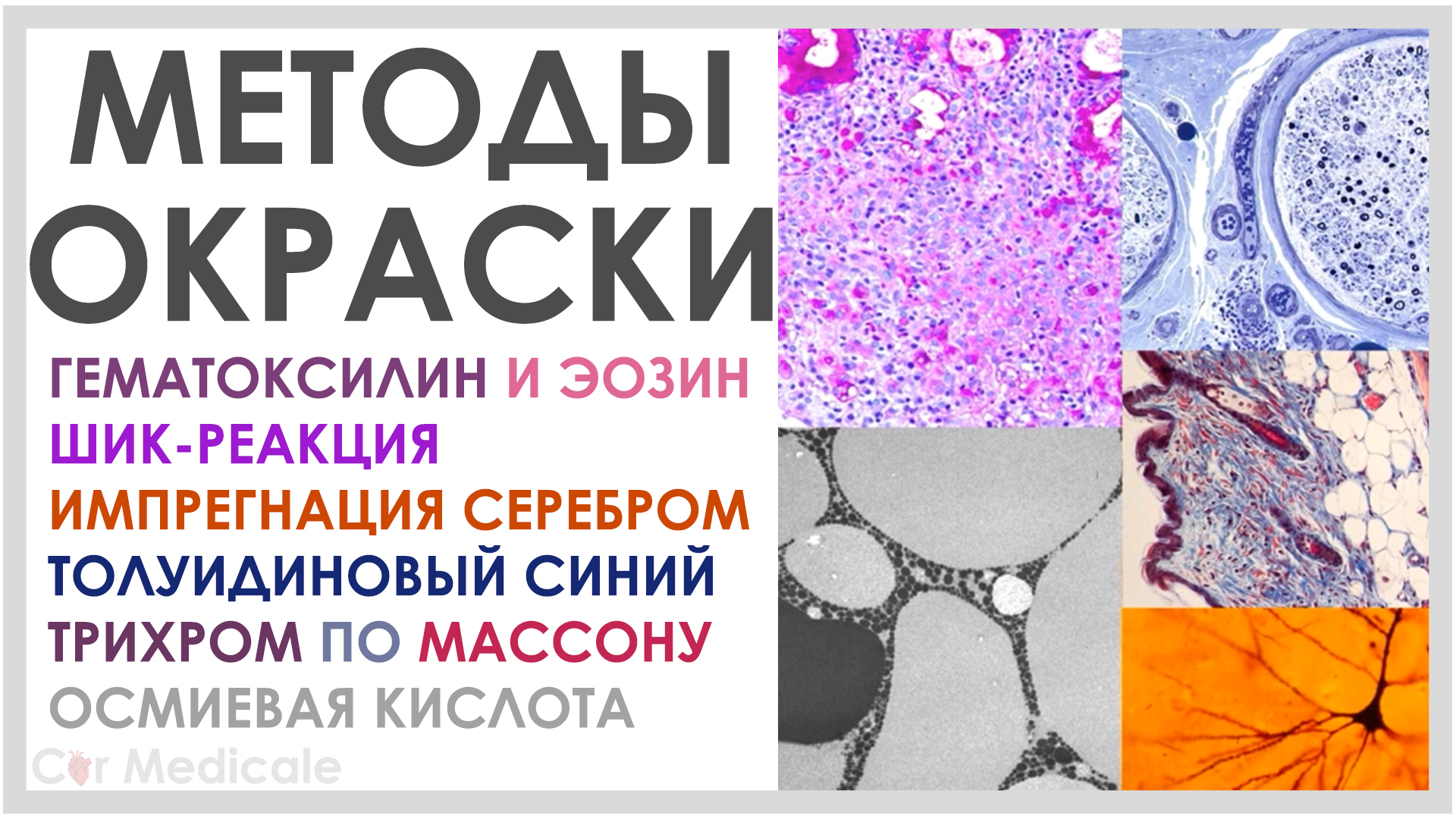 Методы окраски смотреть онлайн
