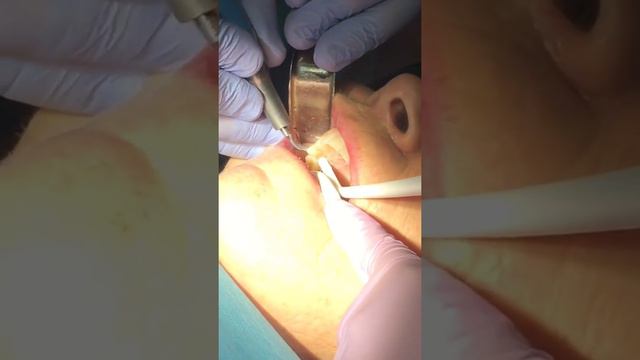 Tooth Extraction - Dr. Q. смотреть онлайн