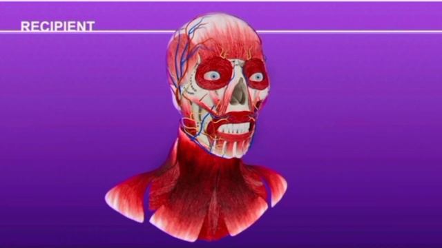 Face Transplant Surgery Procedure || medical 3d animation смотреть онлайн