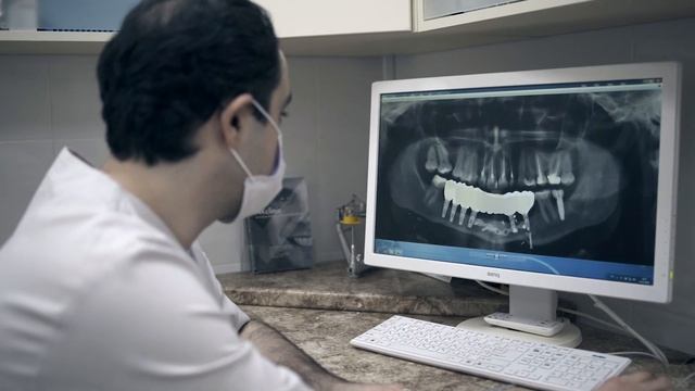 Отзывы пациентов о лечении и имплантации в NKclinic. Рассказ врачей о своем подходе к работе