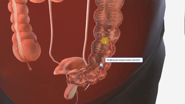 Сепсис(анатомия человека)