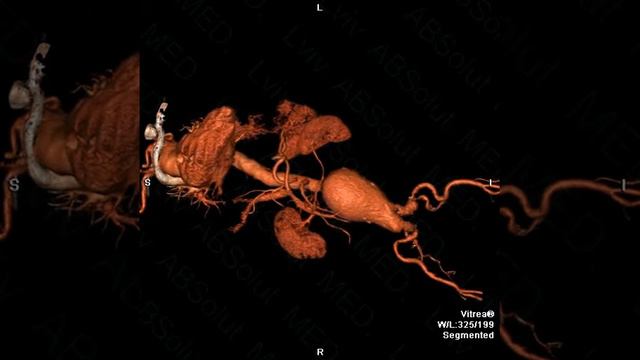 AORTA 910 new смотреть онлайн