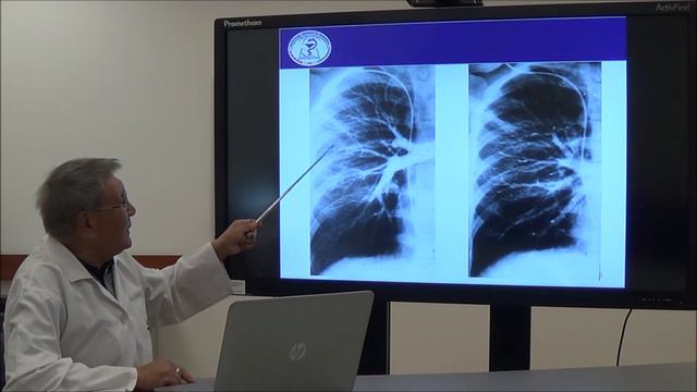Дәріс: «Тыныс алу мүшелері ауруларының сәулелік диагностикасы» смотреть онлайн