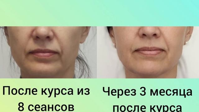 ТИПЫ СТАРЕНИЯ И, КАК С НИМИ БОРОТЬСЯ? смотреть онлайн