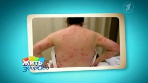 Постельные клопы или домашние клопы. Первый канал.