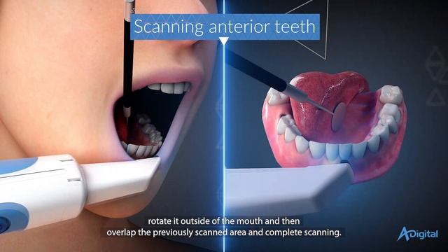 Oral Scanning 2020 - Viz by Adin Digital (Medical Device 3D Animation) смотреть онлайн
