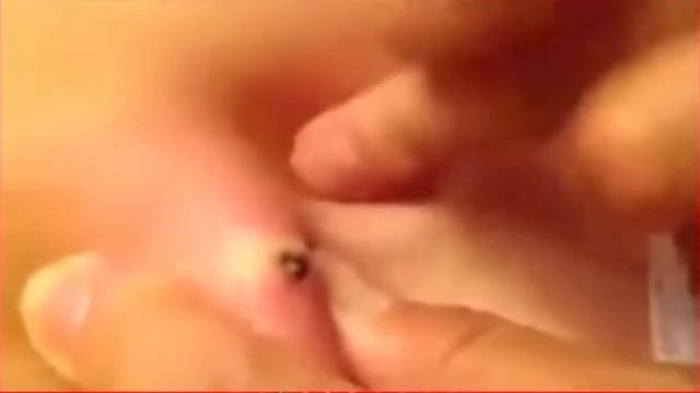 Большая черная точка\КАМЕДОН\Большой жировик