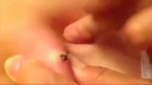 Большая черная точка\КАМЕДОН\Большой жировик