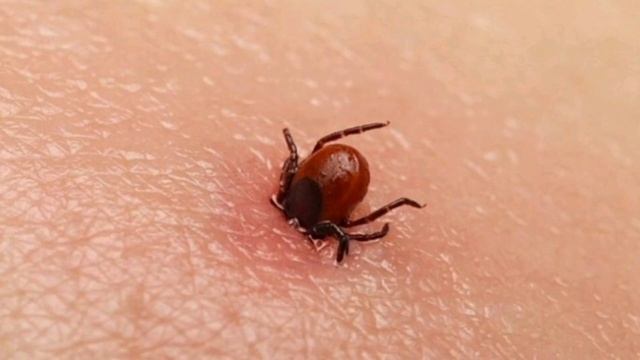 10 укусов насекомых, которые нужно уметь распознавать смотреть онлайн