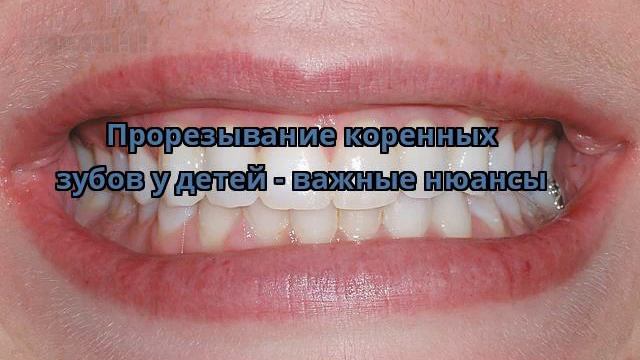Прорезывание коренных зубов у детей - важные нюансы смотреть онлайн