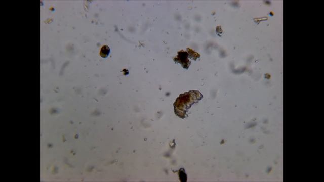 тихоходка под микроскопом