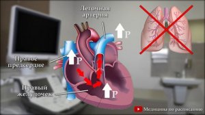 Открытое овальное окно, овальное окно