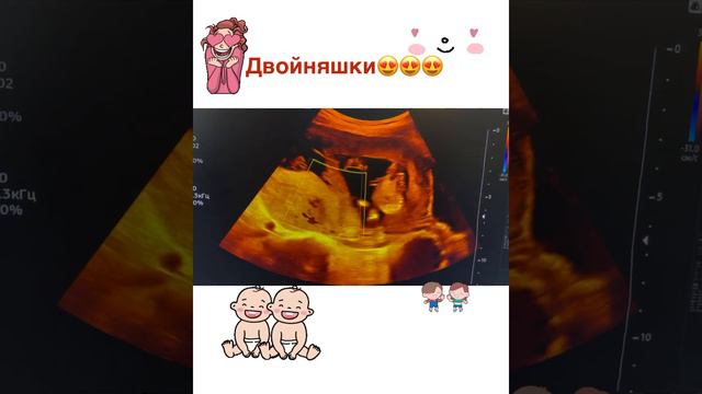 двойняшки 😍😍😍😍 смотреть онлайн