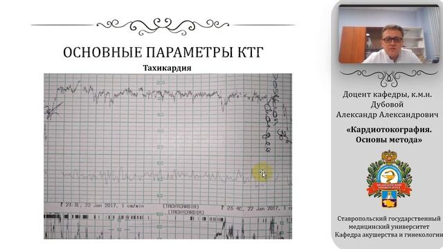Кардиотокография. Основы метода смотреть онлайн