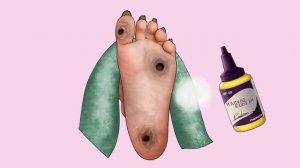 ASMR Piercing & Maggot Infested Finger Removal | Deep Cleaning Animation