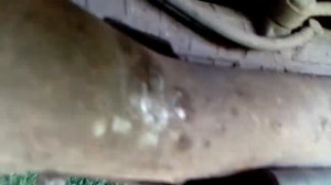 Ремонт креплений защиты картера