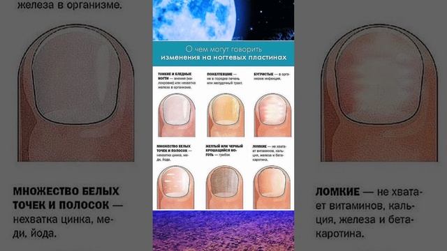 О чем говорят Ваши ногти #здоровье #здоровыйобразжизни #shorts
