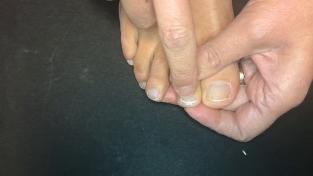 Foot Doctor Trims & Cleans Her Own Toenails смотреть онлайн