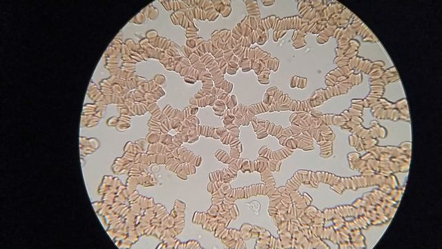 БАРАНИНА повлияла на мою кровь смотреть онлайн