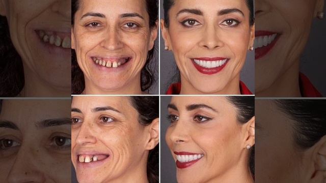 أشخاص تغير شكلهم بسبب الأسنان... شيء لا يصدق 🤯 смотреть онлайн