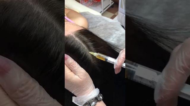 Уход за волосами — плазмолифтинг ? смотреть онлайн