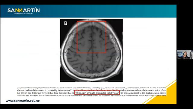 Miércoles Academia Vasculitis 27sept2023 смотреть онлайн