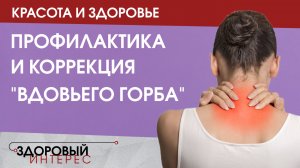 Красота и здоровье. Комплекс упражнений «Холка минус»