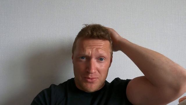 7 месяцев после пересадки волос . смотреть онлайн