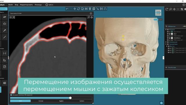 Просмотр серии DICOM изображений смотреть онлайн