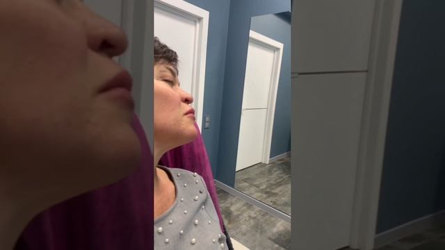 Коррекция угла нижней челюсти филлерами. Позволяет создать красивый профиль лица. смотреть онлайн