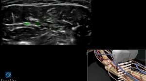 3D-пособие: Блокада срединного и локтевого нервов под контролем ультразвука