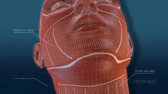 Ulthera (Альтера) в центре врачебной косметологии "Персона Beauty". От бренда к тренду. смотреть онлайн