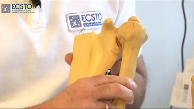 Лечение в клинике ECSTO смотреть онлайн