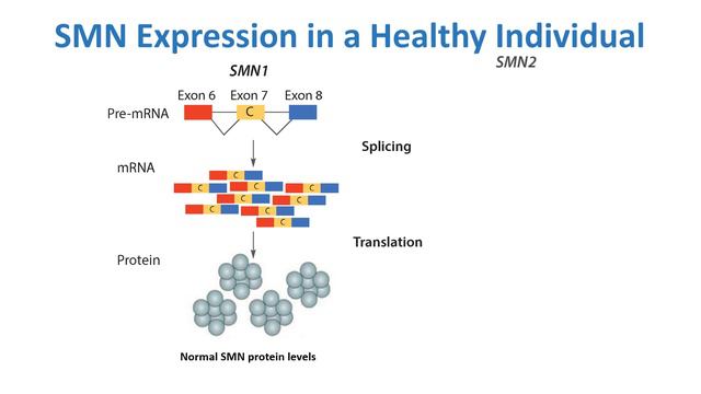 Genetics of SMA смотреть онлайн