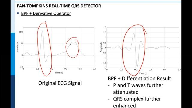 Pan-Tompkins Algorithm смотреть онлайн