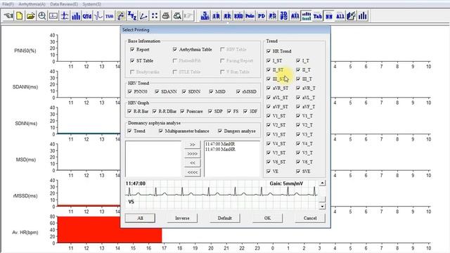 Contec TLC5000 ekg holter, PRINT REPORT смотреть онлайн