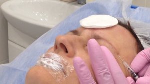 Меди Лайт; Мезоботокс. Устранение морщин. Область вокруг глаз