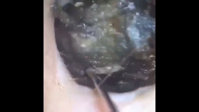 Брр..ушная сера.. Смотри что в ушах! смотреть онлайн