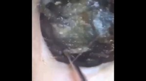 Брр..ушная сера.. Смотри что в ушах!