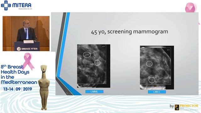 How to avoid a diagnostic underestimation? Breast surgeon/radiologist | Stamatis Merkouris смотреть онлайн