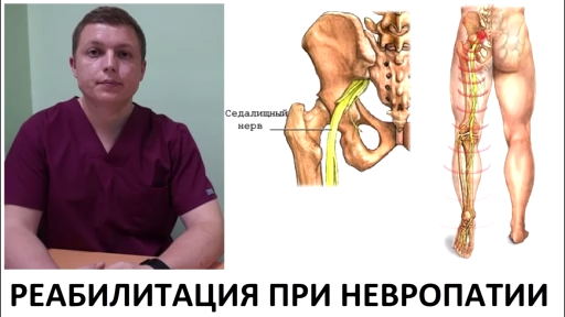 Седалищный нерв Реабилитация при невропатии Medical Rehabilitation Sciatic Neuropathy 