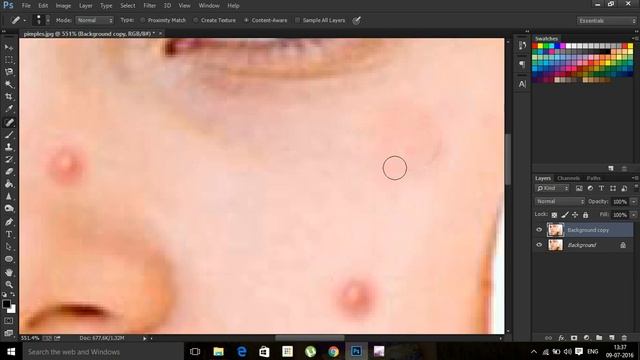Adobe Photoshop 2016 :how to remove pimples from face in photoshop 2016 смотреть онлайн