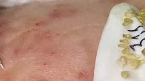 Enjoy Every Day With The Best Video Loan Nguyen Spa Official  2657